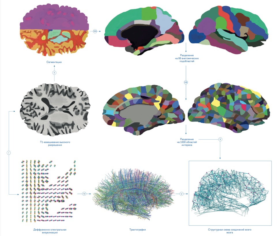 рис. 01  Схема исследования мозга на основе магнитно-резонансных изображений