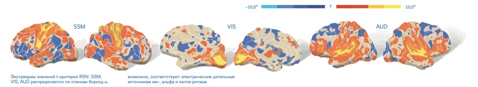 Рис. 03 Топография экстремумов сенсорных и моторных RSN относительно борозд мозга 
