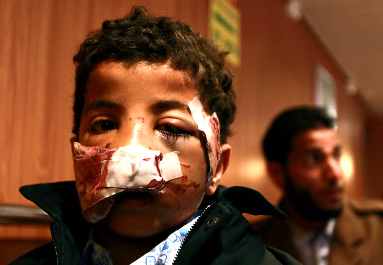 Убийства детей в Сирии совершаются разными способами. Многие были зарезаны в ходе массовых убийств в таких районах как аль-Хуля и Карм аз-Зайтун в провинции Хомс. По некоторым данным, около тысячи детей погибли во время газовой атаки 21 августа 2013 года в Гуте