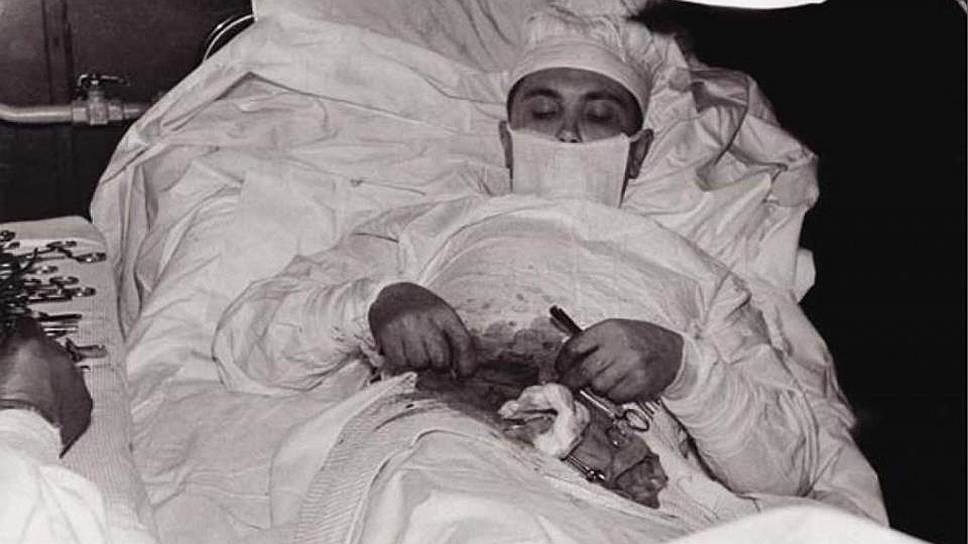 1961 год. Хирург Леонид Рогозов успешно выполнил на себе операцию аппендэктомии (удаление червеобразного отростка слепой кишки при его воспалении — аппендиците)