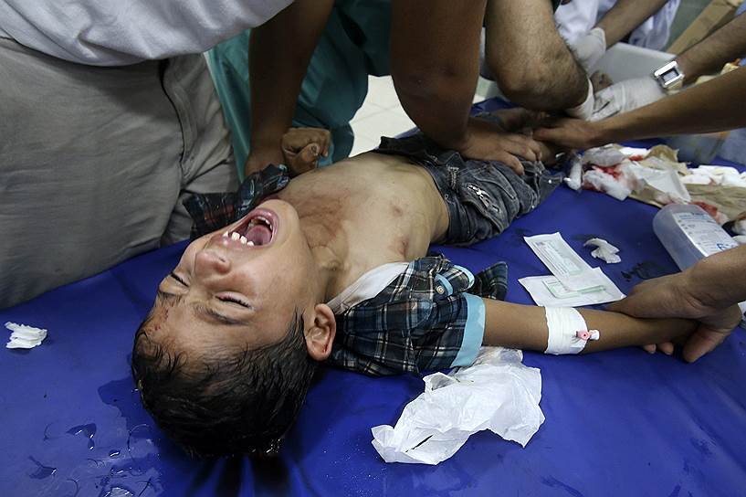 Палестинский мальчик, раненый во время израильской атаки, в госпитале в Рафахе на юге Сектора Газа