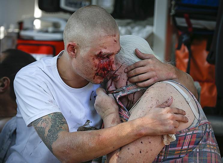 Местные жители, раненые во время обстрела Донецка