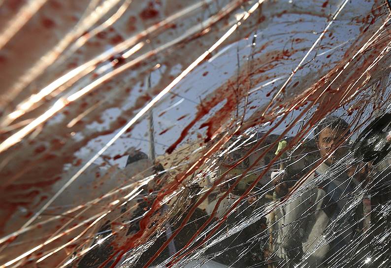 Последствия взрыва бомбы в Кабуле, Афганистан