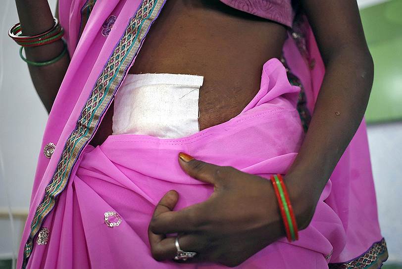 Биласпур, Индия. Женщина, подвергшаяся процедуре стерилизации, сидит на койке в окружной больнице. От травм, полученных в ходе массовой стерилизации в индийском штате Чхаттисгарх, скончались восемь женщин, еще 15 находятся в критическом состоянии. Стерилизация проводилась в специальном медицинском лагере, организованном при участии правительства штата в рамках программы по контролю за рождаемостью.
