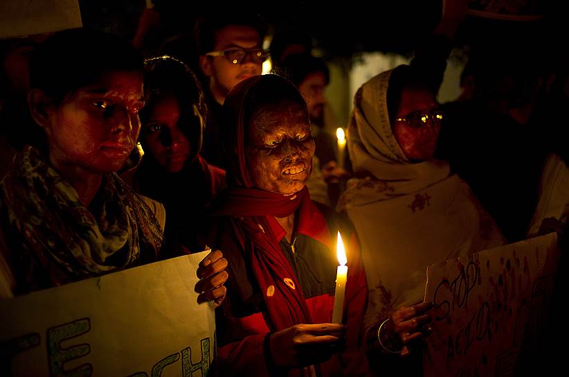 Нью-Дели, Индия. Женщины-жертвы обливания кислотой во время акции против насилия в отношении женщин в годовщину группового изнасилования студентки со смертельным исходом, которое привело к многочисленным акциям протеста в стране
