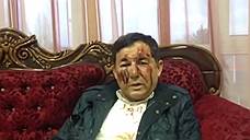 Лидер дагестанских справороссов избит в Махачакале