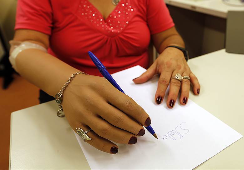 Стелла Азамбулло стала одной из первых женщин в Латинской Америке с искусственной рукой. В 2007 году она потеряла руку в аварии и спустя семь лет вернулась к обычной жизни благодаря изобретению Bioparx Health Technology company