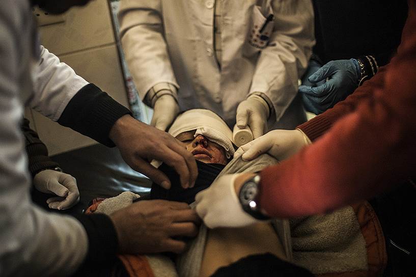 Мосул, Ирак. Врачи обследуют девочку, которую боевики «Исламского государства» ранили в глаз