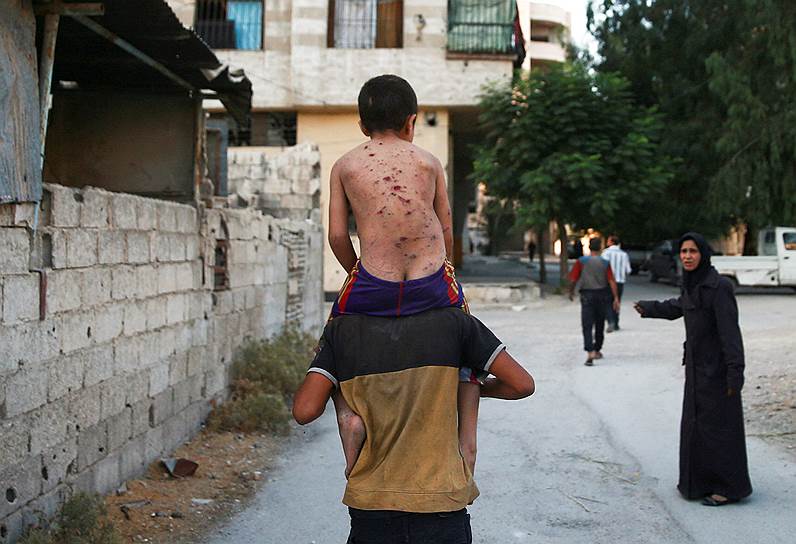 Арбин, Сирия. Мужчина несет раненного в спину мальчика на плечах