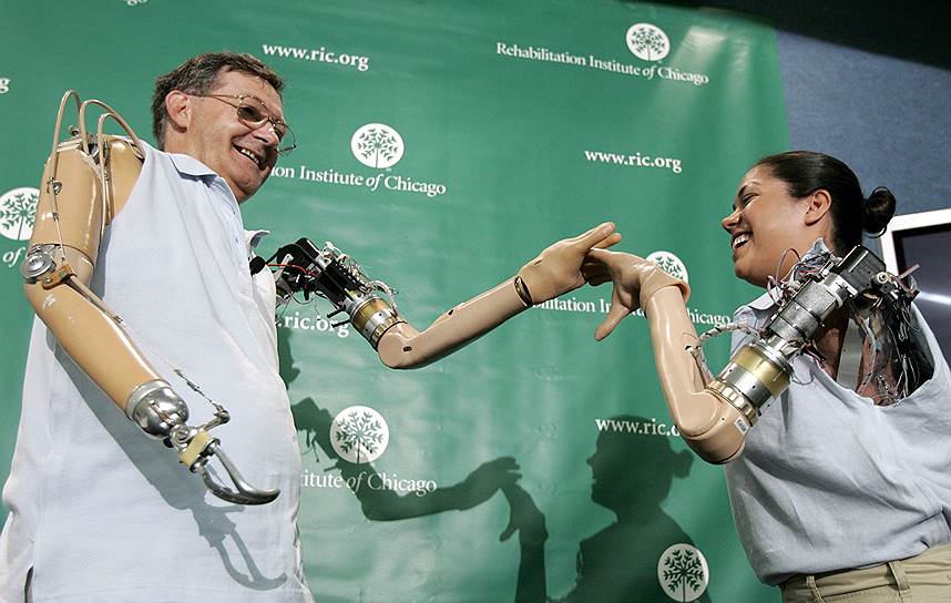 Клодия Митчелл и Джесси Салливан стали в 2006 году первыми в мире обладателями бионических протезов, которые управляются усилием мысли