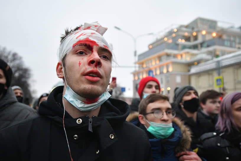 Участник со следами побоев во время митинга в Москве