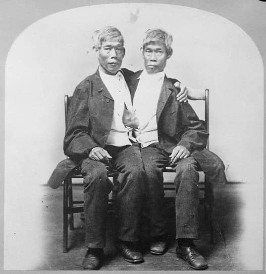 Сросшиеся близнецы Энг (слева) и Чанг Банкер в Нью-Йорке, около 1860