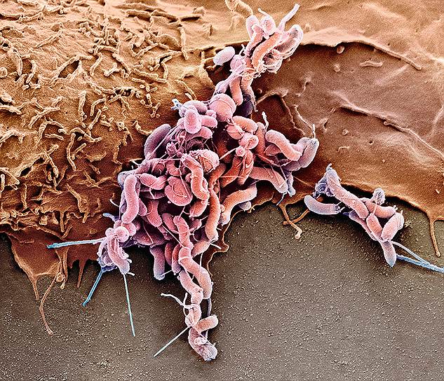 Электронная микрофотография H. Pylori (розовый цвет) на клетках эпителия желудка человека (коричневый)