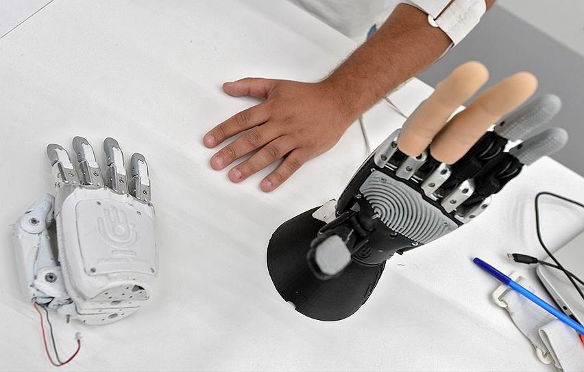 С каждой новой моделью бионические протезы верхних конечностей по виду и функциональности все больше приближаются к человеческим рукам 