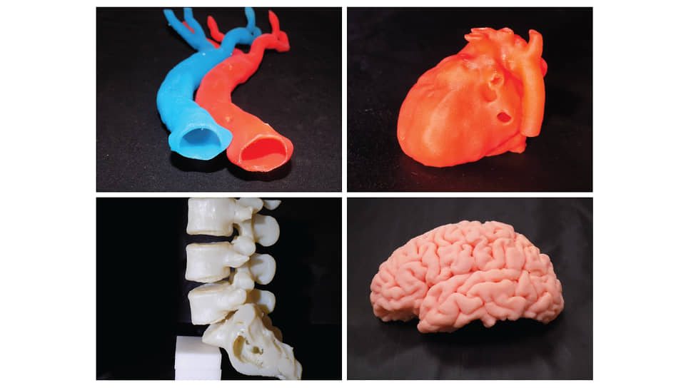 Здесь другое, более простое, но тоже важное применение 3D-печати — модели органов для подготовки к операции и иных медицинских целей