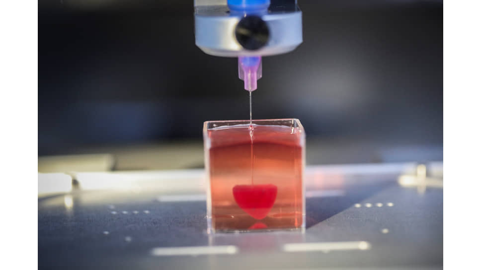 Биологическая 3D-печать устраняет проблему отторжения пересаженного органа