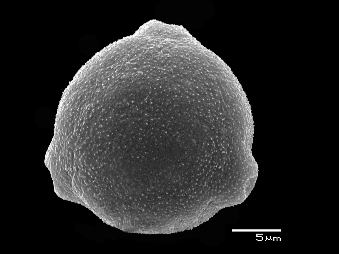 Пыльца березы бородавчатой под сканирующим электронным микроскопом (3000-кратное увеличение)