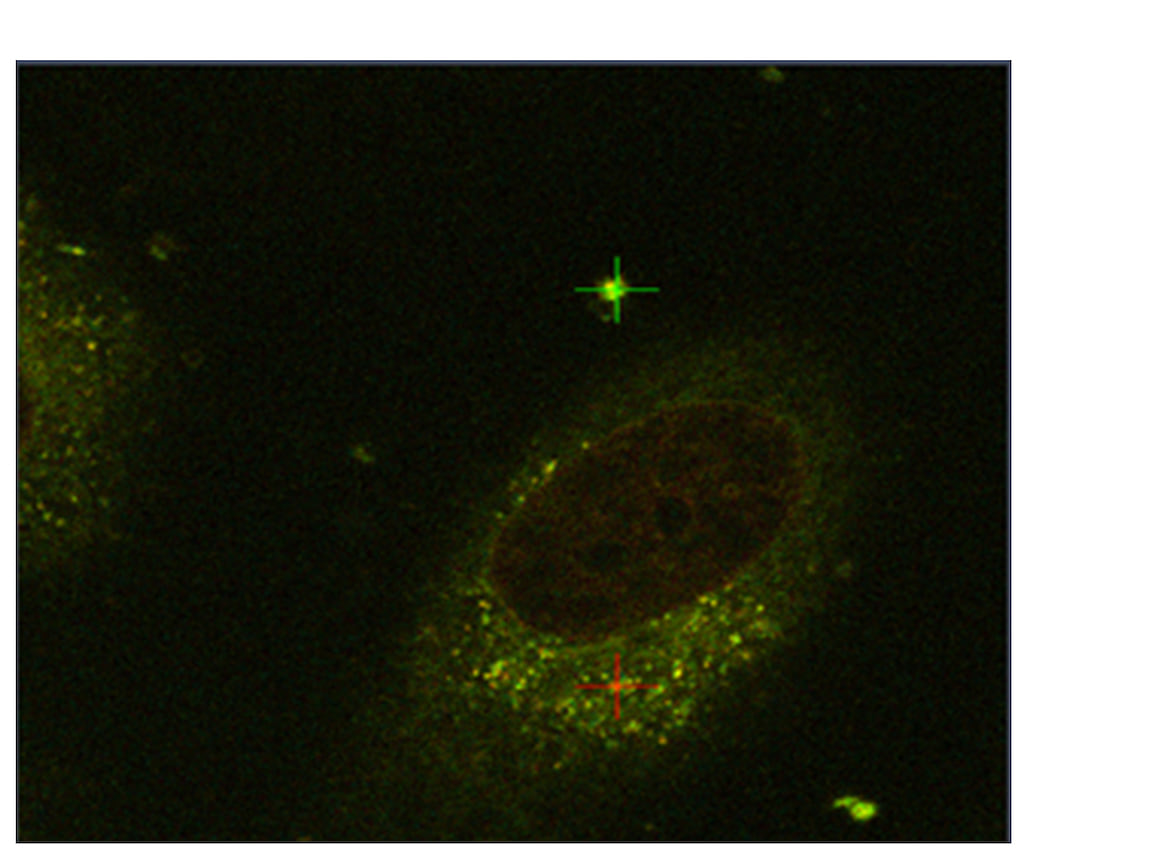Конфокальные изображения опухолевых клеток после инкубации с наночастицами (НА-DOX:CS) в течение 24 часов