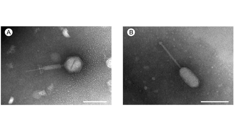 Электронная микрофотография (просвечивающая электронная микроскопия) вирионов нового фага Enterococcus phage GVEsP-1 (А) и Enterococcus phage SSsP-1 (В). Указана шкала  100 nm