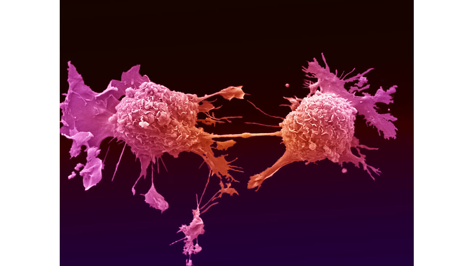 Как ученые научили прибор выделять раковые клетки