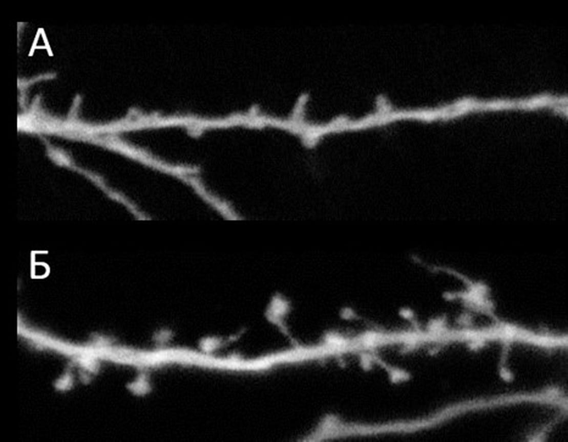 Микрофотографии дендритного фрагмента нейрона гиппокампа мыши. А — в условиях амилоидной токсичности контакты, формируемые выростами (шипиками) на теле дендрита, разрушены. Б — тестируемый препарат в концентрации 100 нМ в присутствии амилоидной токсичности восстанавливает структуру шипиков, увеличивая число контактов между нейронами