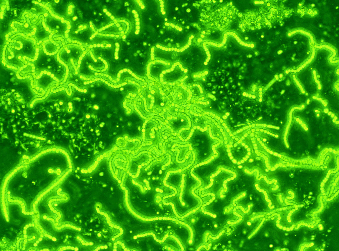 Цианобактерии (микрофотография)