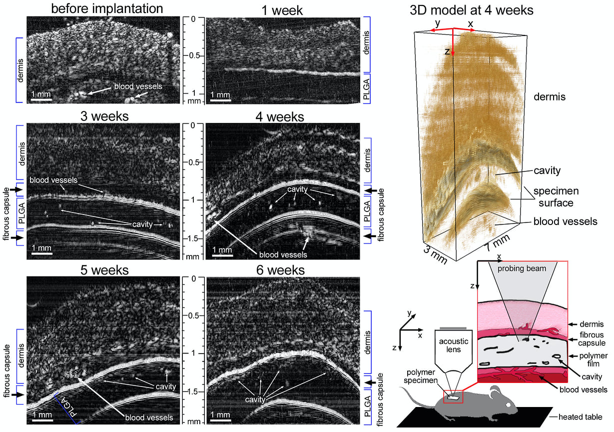 Ультразвуковые изображения образца PLGA на различных стадиях деградации in vivo. XZ-сканы отображают структуру в вертикальном поперечном сечении: дерма, имплантированная полимерная пластинка, окруженная фиброзной капсулой, поры и полости, образованные в полимере, и кровеносные сосуды