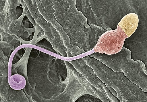 Зарождение сперматозоидов в тестикулах. В последние годы среди этой армии встречается все больше увечных «бойцов» с деформированными жгутиками и ядрами