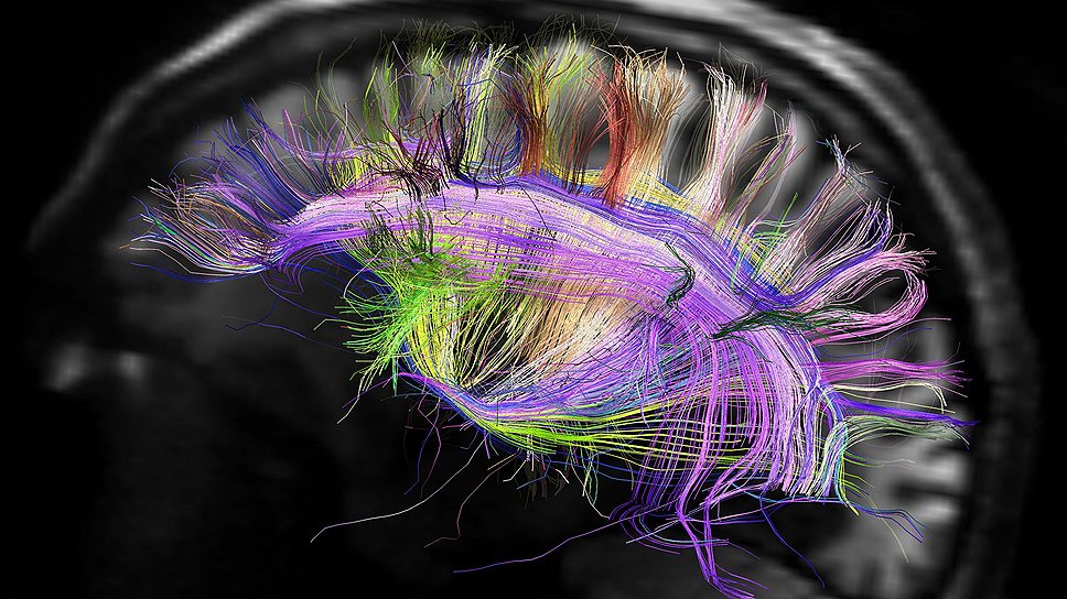 Трехмерная модель нейронных связей в мозге человека, полученная методом томографии при реализации проекта Connectome