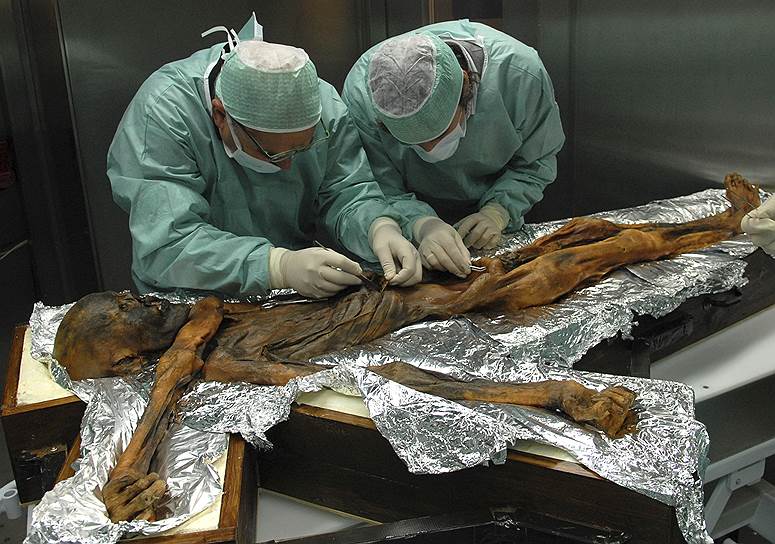 Чтобы найти желудок мумии Эци, ученые применили методы компьютерной томографии
