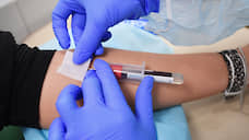 «Тесты на вирус — это дополнительный стресс»