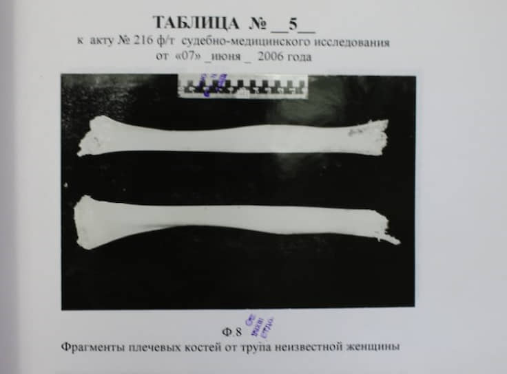 Фрагменты плечевых костей от трупа неизвестной женщины, фото из материалов уголовного дела