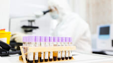 12 пациентов с коронавирусом скончались в Удмуртии