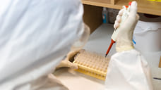 9 заболевших коронавирусов жителей Удмуртии скончались за последние сутки