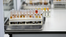 Суточная заболеваемость COVID-19 в Удмуртии выросла до 418 случаев