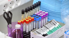 В КФУ планируют запустить производство тестов на антитела к COVID-19