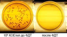 Нижегородские ученые нашли замену антибиотикам для лечения инфекций в урологии