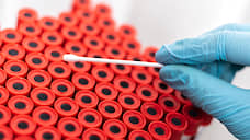 В Прикамье выявили 18 новых больных коронавирусом