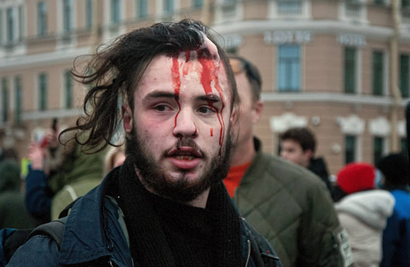 Несогласованная акция сторонников оппозиционера Алексея Навального в центре города. Участник с разбитой головой во время акции