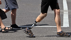 Протезисту нижних конечностей в Сочи готовы платить от 400 тысяч рублей