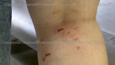 В Минводах возбудили уголовное дело после нападения бродячих собак на девочку