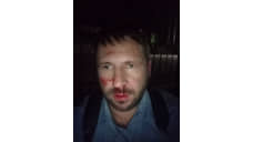 Полиция проводит проверку после нападения на наблюдателя на выборах в Воронежской области