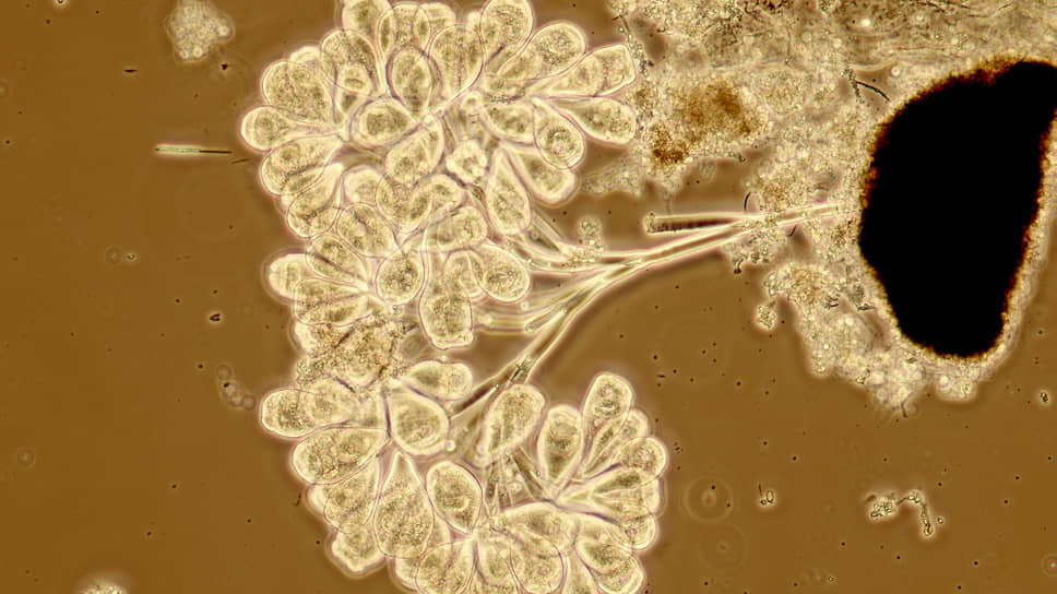 Микроорганизмы вида Epistilis