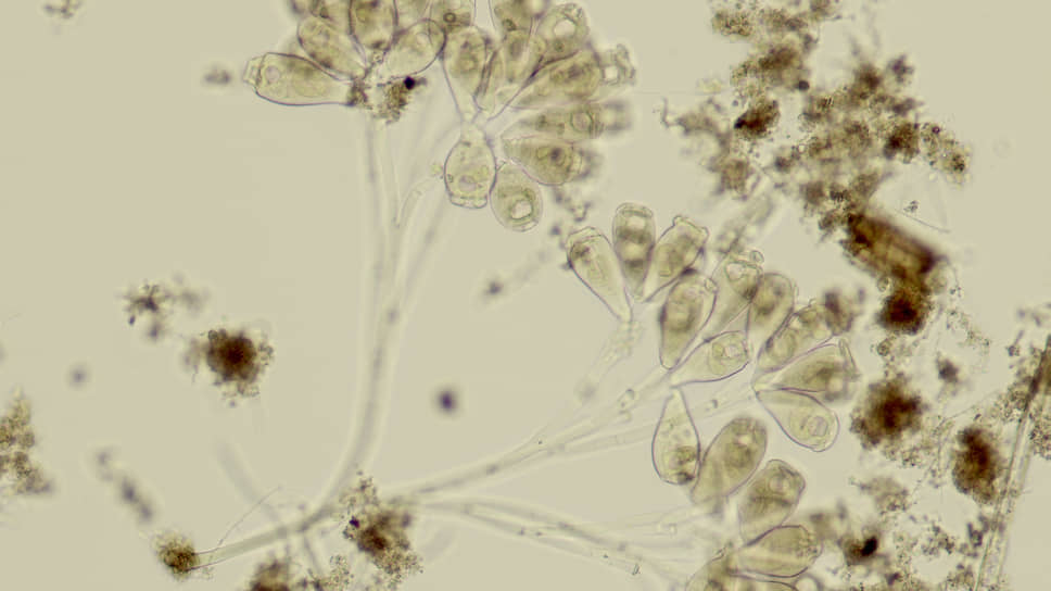 Микроорганизмы вида Epistilis