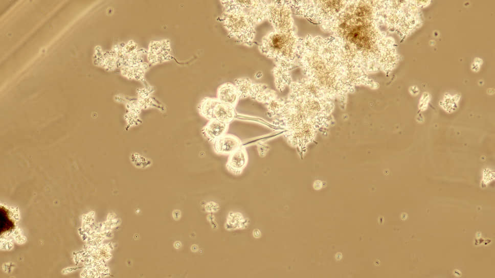 Микроорганизмы вида Vorticella